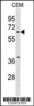 SPS2L Antibody (N-term)