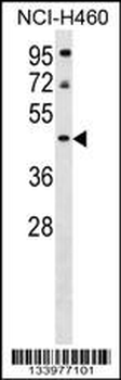 PLEKHA9 Antibody (C-term)