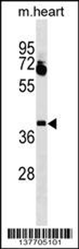 LBX1 Antibody (Center)