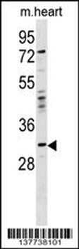 OTP Antibody (Center)