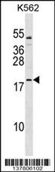 TCF15 Antibody (Center)