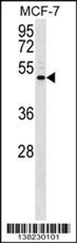ENPP5 Antibody (C-term)