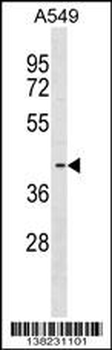 FADS3 Antibody (C-term)