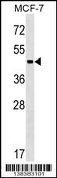 ZBTB12 Antibody (C-term)