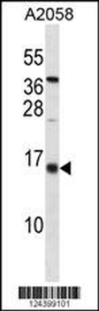 ID3 Antibody (C-term)