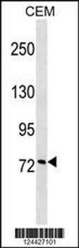 CCNF Antibody (Center)