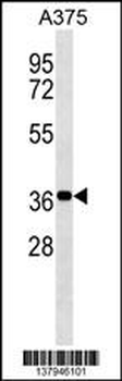 NSMCE1 Antibody (C-term)