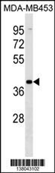 VN1R2 Antibody (N-term)