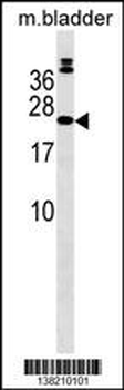 COMMD10 Antibody (Center)