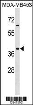Mouse Hoxa9 Antibody (Center)