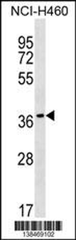 RAB36 Antibody (C-term)