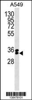 FBXO44 Antibody (N-term)