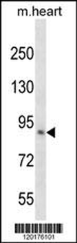KLHL1 Antibody (N-term)