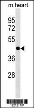 HHEX Antibody (C-term)