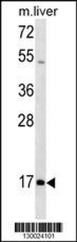 HOXA1 Antibody (N-term)