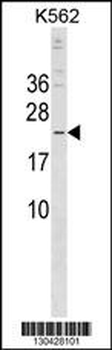 CRYBB3 Antibody (C-term)