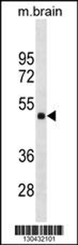HMBOX1 Antibody (Center)