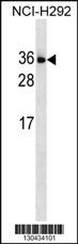 IL34 Antibody (N-term)