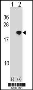 NANOS2 Antibody (Center)