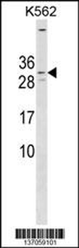 KCNE4 Antibody (Center)