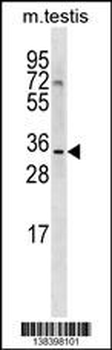 SHARPIN Antibody (Center)