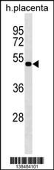 LHX8 Antibody (Center)