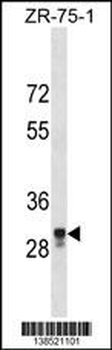 MPPED2 Antibody (C-term)