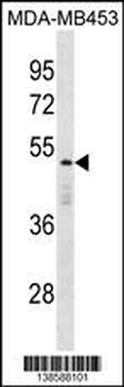 DEDD Antibody (Center)