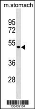 ANXA10 Antibody (C-term)