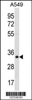 ECH1 Antibody (C-term)