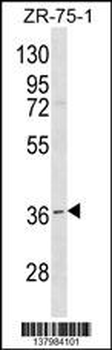 RNF144B Antibody (Center)