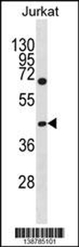 GCNT6 Antibody (C-term)
