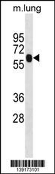 ENO4 Antibody (Center)