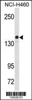 KIT Antibody (Center S746)