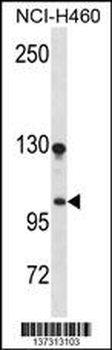DLGAP3 Antibody (N-term)