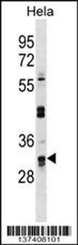 UTP11L Antibody (C-term)