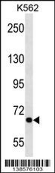 ALS2CR8 Antibody (N-term)