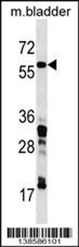 CORO1C Antibody (C-term)