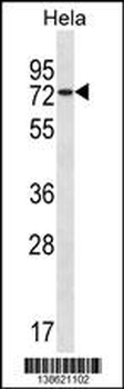 USP39 Antibody (Center)