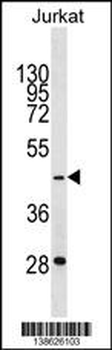 GTF3A Antibody (C-term)