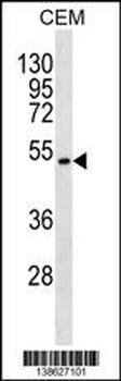 TOM1L2 Antibody (C-term)