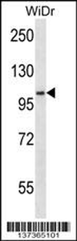 SDCCAG1 Antibody (N-term)