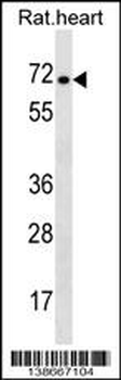 Rat Stra6 Antibody (C-term)