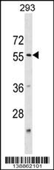 KATNA1 Antibody (N-term)