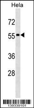 STAU1 Antibody (N-term)