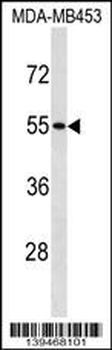 SKAP1 Antibody (C-term)
