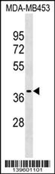 P2RX3 Antibody (C-term)