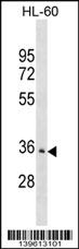 PDLIM3 Antibody (C-term)