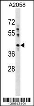 PTPLAD1 Antibody (N-term)