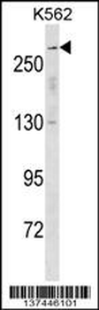 SCN5A Antibody (N-term)